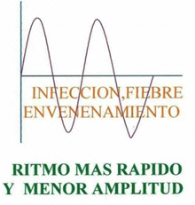 Onda Craneosacral