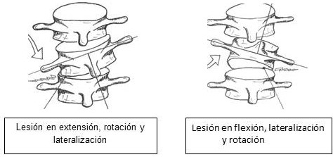 lesión Vértebras